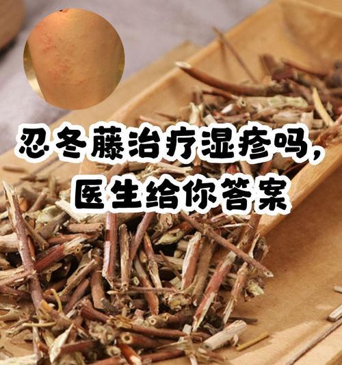 忍冬的养护技巧和注意事项有哪些？
